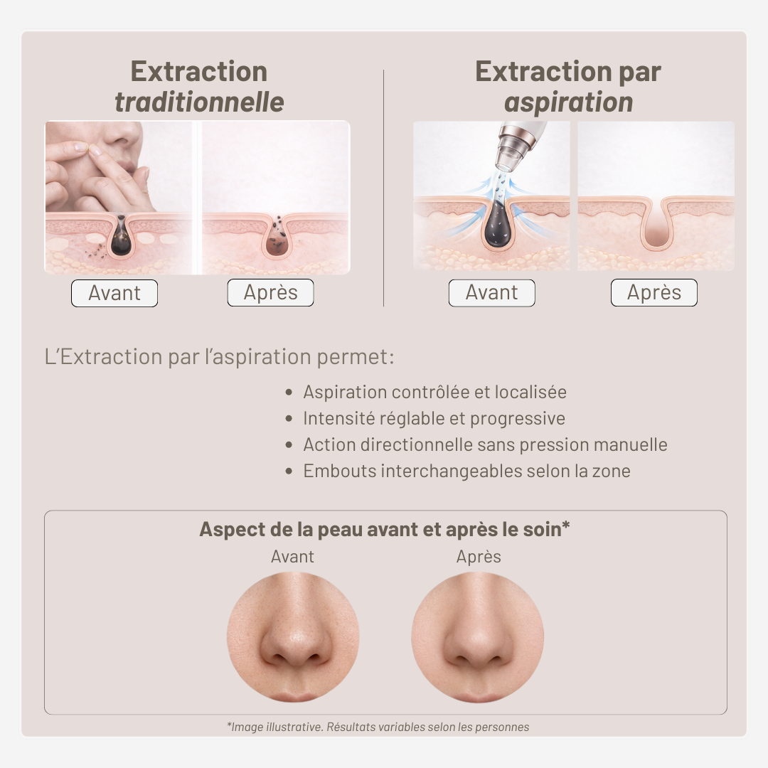 Aspirateur dermatologique pour points noirs