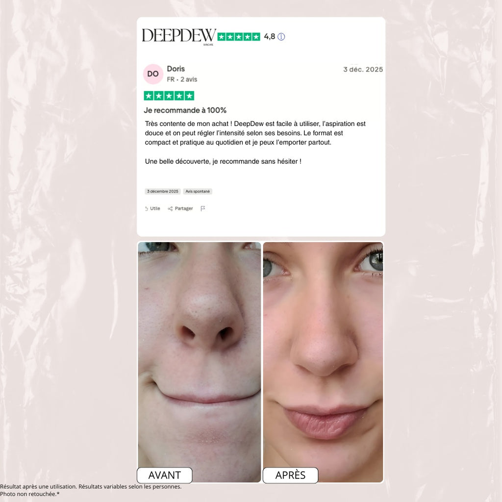 Aspirateur dermatologique pour points noirs