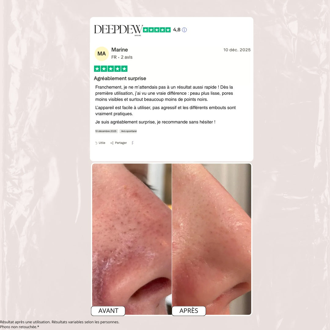 Aspirateur dermatologique pour points noirs