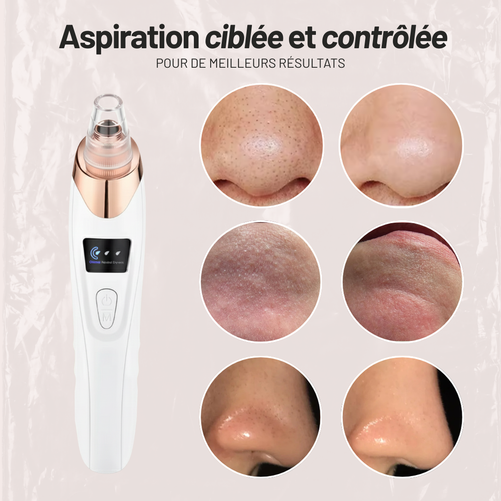 Aspirateur dermatologique pour points noirs
